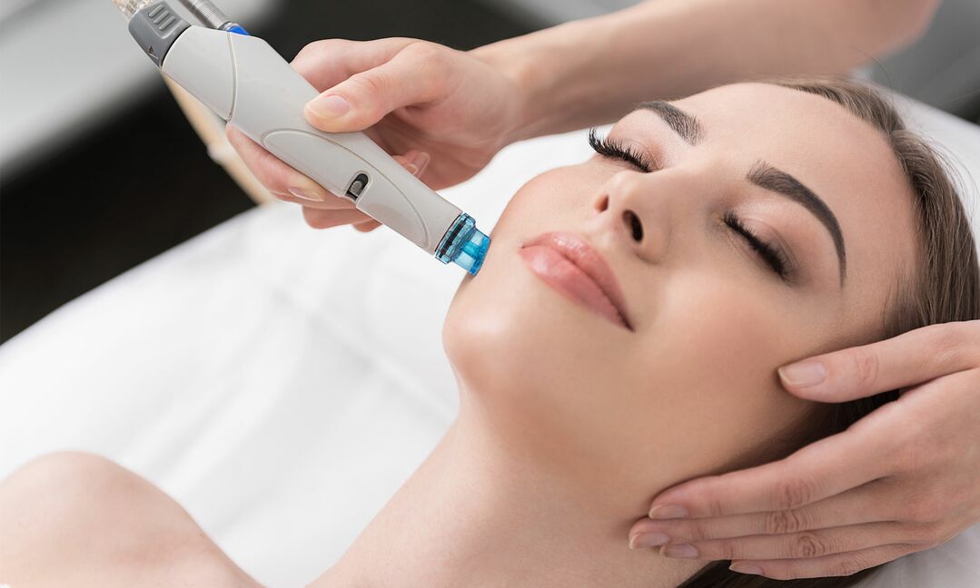 HydraFace kezelés